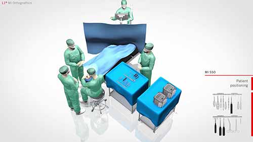 正颌手术器械和植入物