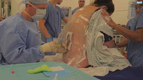 剖宫产的脊髓麻醉