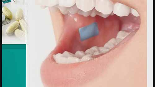 生物粘附给药系统