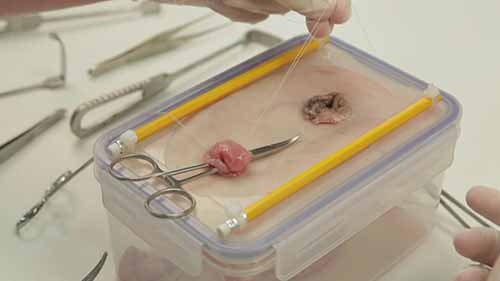 模拟结肠造口和回肠造口术