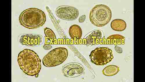寄生虫学——粪便检查技术