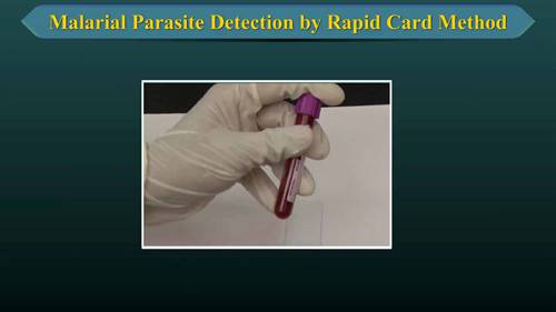 疟疾寄生虫检测方法