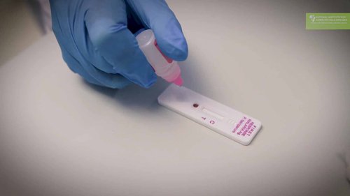 如何使用疟疾快速诊断试剂盒