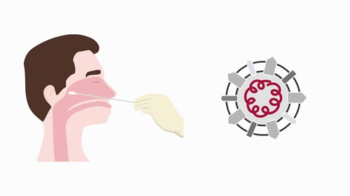 逆转录检测新冠病毒