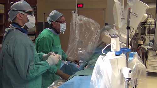 血管造影和血管成形术