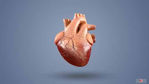 血管成形术医学动画