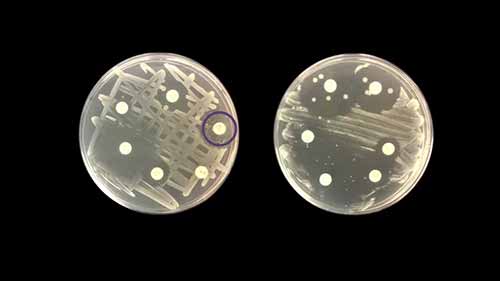 抗生素敏感性测试