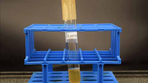 显微镜下的细菌