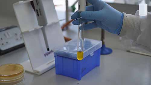 使用生化检验鉴定细菌2