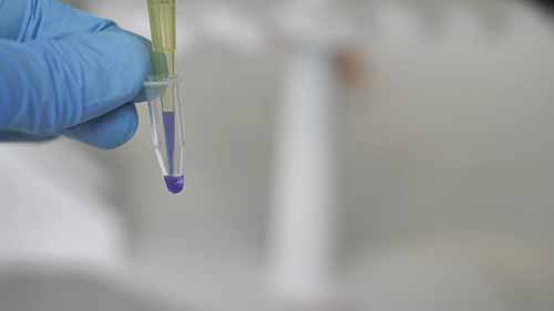 SDSPAGE蛋白分析2样品制备