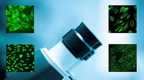 IFA检测2IFA模式识别与HEp-2细胞