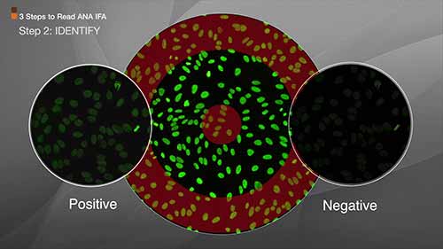 IFA检测3如何阅读抗核抗体IFA模式