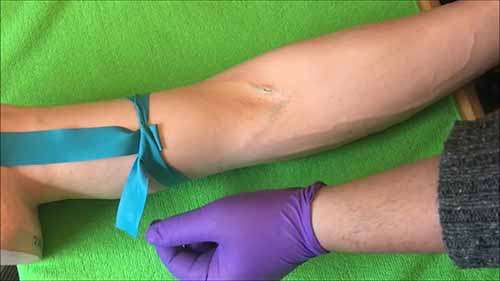 采血技巧——止血带操作流程