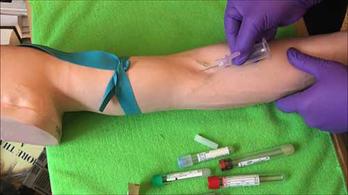 采血技巧——直式针采血