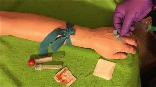 采血技巧——蝶翼针采血