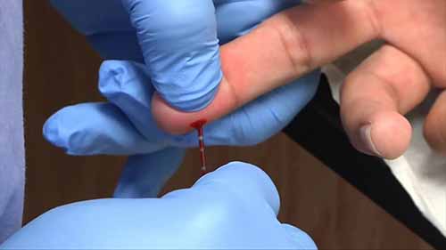 毛细血管采血操作