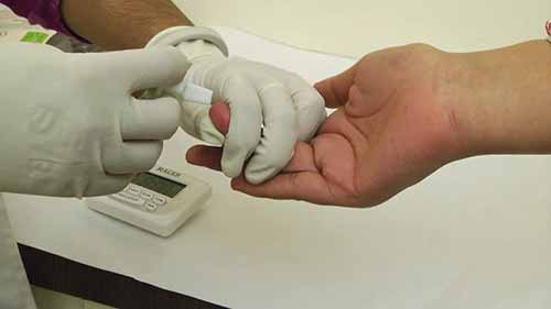 毛细血管采血讲座