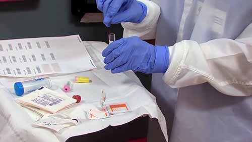 通过毛细管穿刺取血样