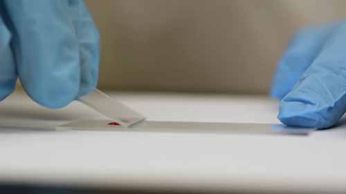 做血涂片检查白细胞计数