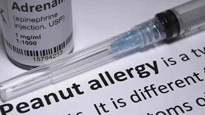 花生过敏的口服药物