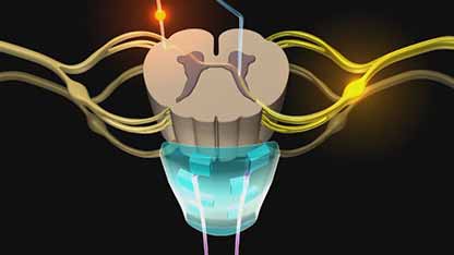 闭路脊髓电刺激