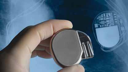 心脏植入装置感染预防