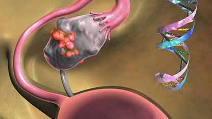 作为卵巢癌维持治疗药物的PARP抑制剂