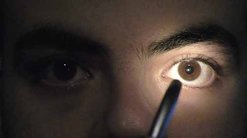 眼科技能——瞳孔检查