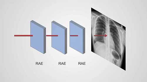 了解胸部X光——重叠的重要性