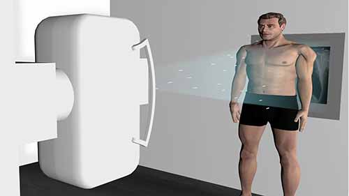 X射线的工作原理