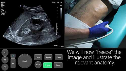 超声教程——尿路检查