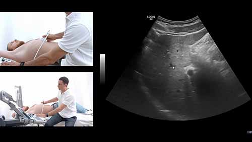 如何使用超声检查肝脏