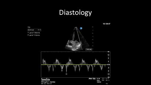 多普勒超声原理