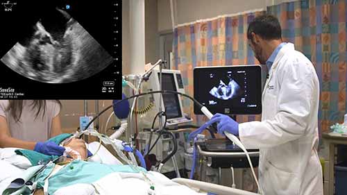 经食道超声心动图——图像获取