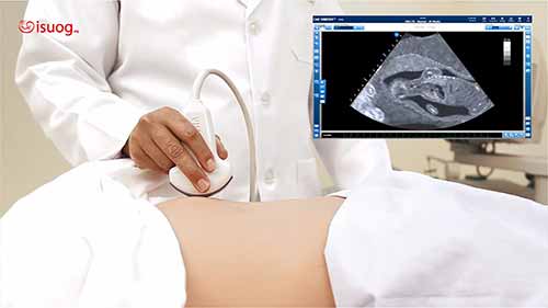 超声探头移动方法