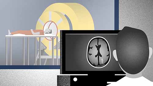 磁共振仪工作原理