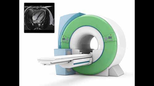 心脏磁共振适成像