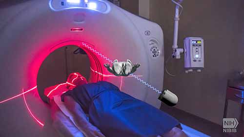 CT扫描工作原理