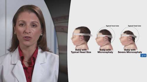 测量婴儿头围 1