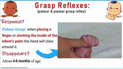 新生儿反射评估