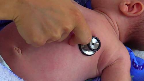 新生儿心率评估