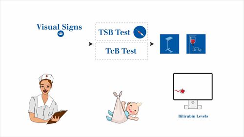 如何筛查新生儿黄疸
