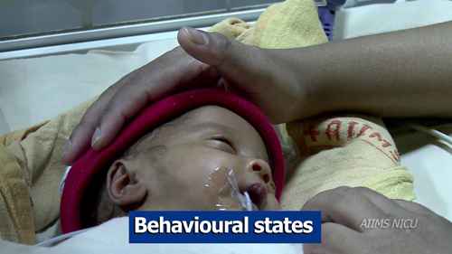 早产儿不同行为评估