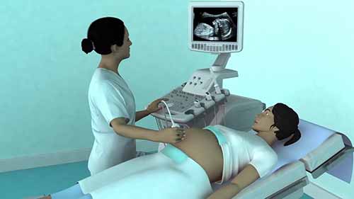 产科超声检查的基本步骤