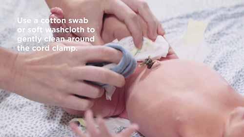 如何护理脐带