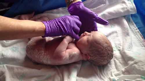 新生儿评分和检查