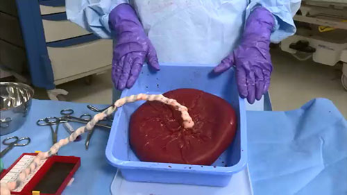 如何分娩和检查胎盘