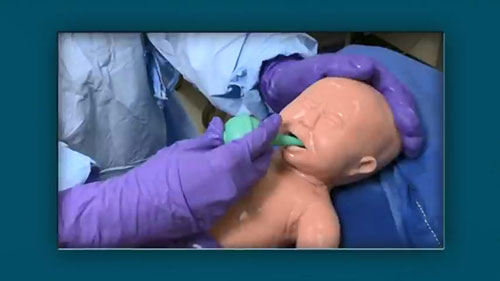 如何进行自然分娩