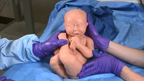 臀位分娩模拟演示