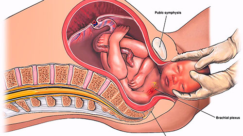 危险的分娩并发症